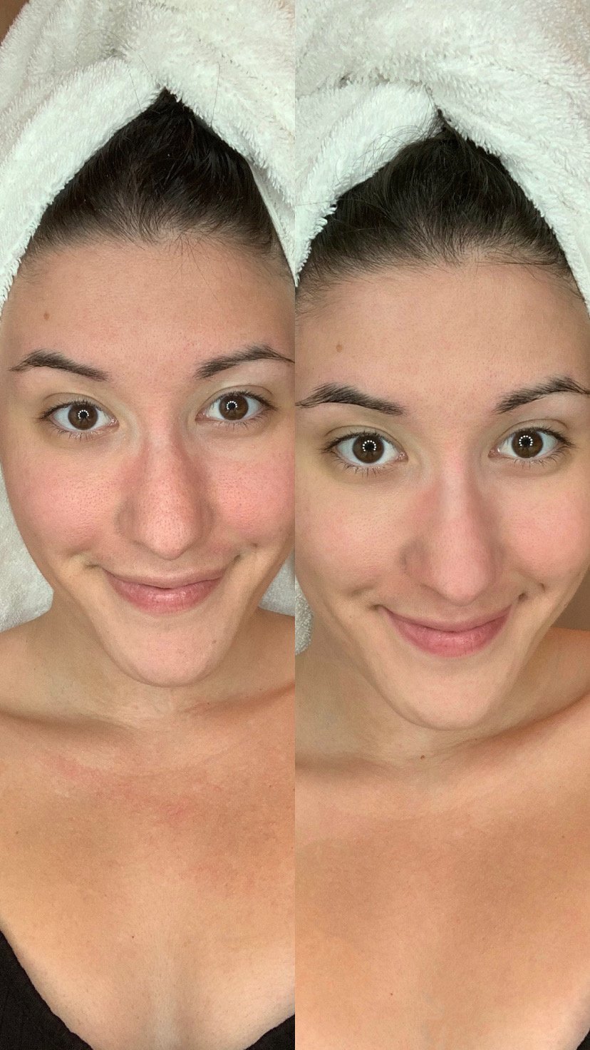 FaceCompostPurplePowerMask_Influencer@thatchicnxtdoor_Before&After