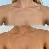 Hempitan_@alykingg_Before&After_Chest