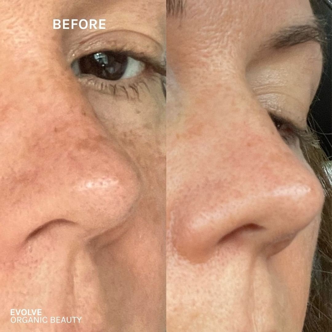 R+N Serum Before & After image 3 jpg