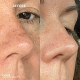 R+N Serum Before & After image 3 jpg