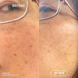 R+N Serum Before & After image 4