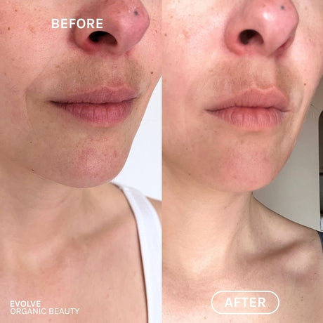 R+N Serum Before & After image 5