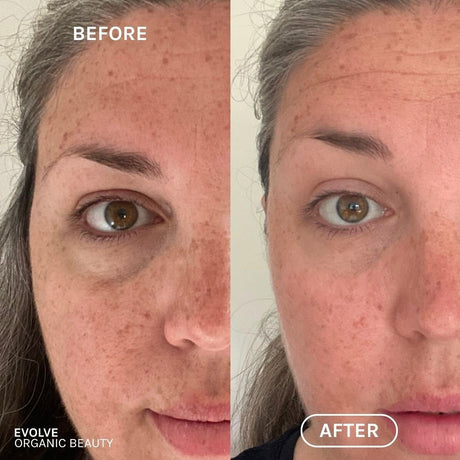 R+N Serum Before & After image 6