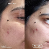 R+N Serum Before & After image 7