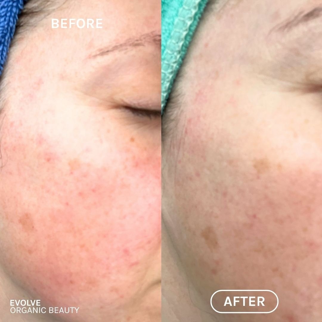 R+N Serum Before & After image2